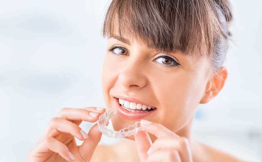 young woman inserting clear aligners onto her teeth