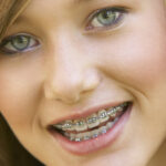 young woman smiles showing off her braces